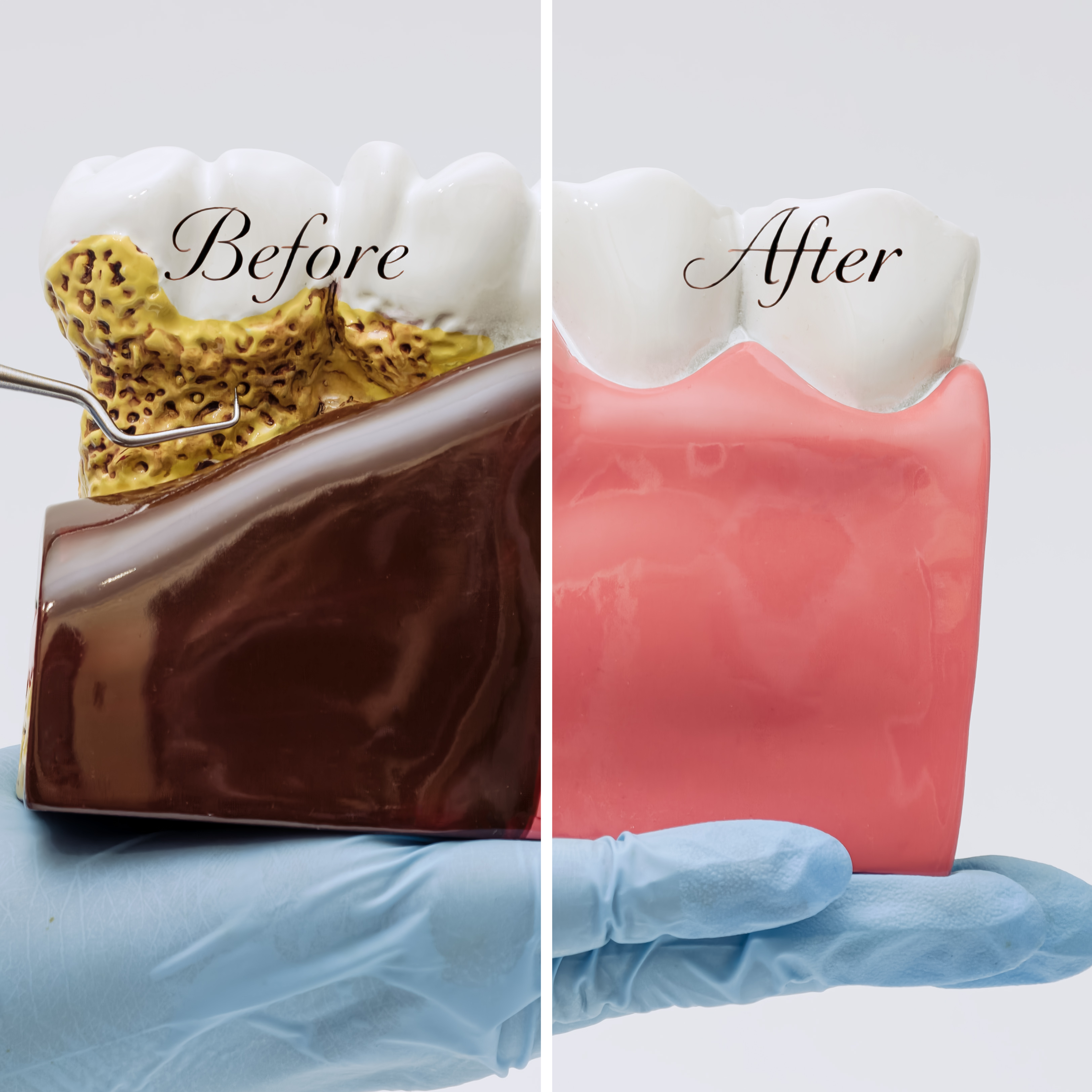 Dents & Gencives