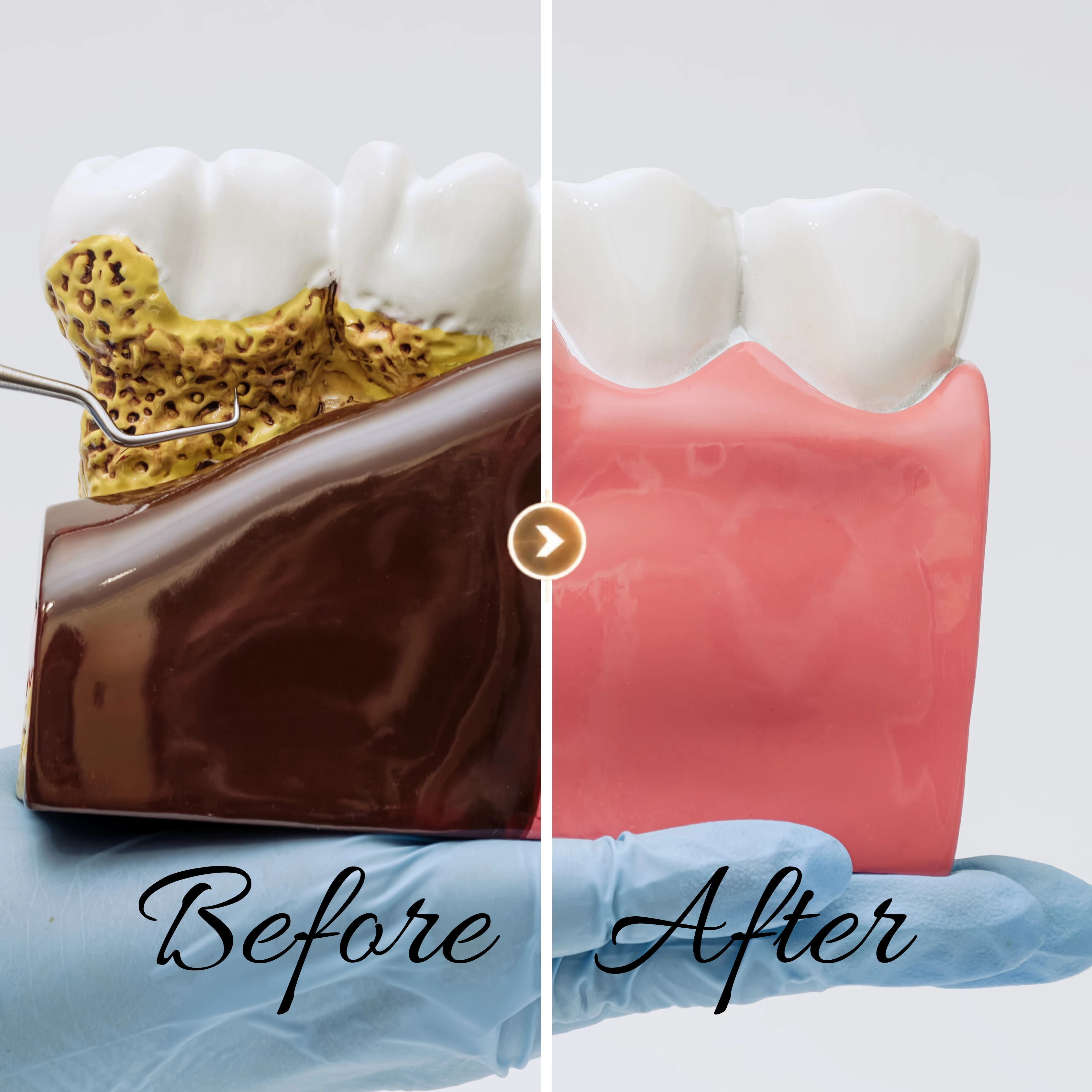 Dents & Gencives